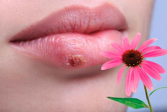 Te explicamos como curar el herpes en el labio con echinacea