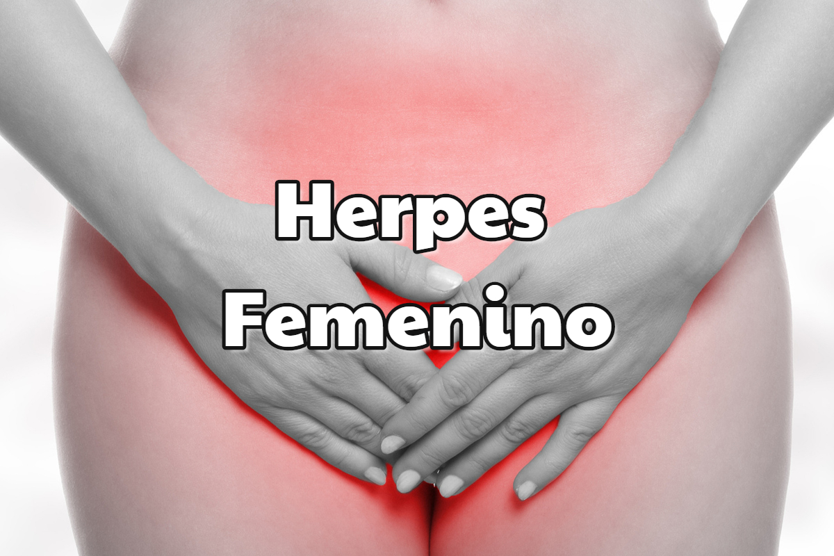 herpes femenino tratamientos efectivos